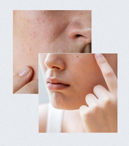 Anua Birch Moisture Boosting Serum 70% 30ml