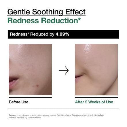 Anua – Heartleaf 80% Soothing Ampoule - 30ml